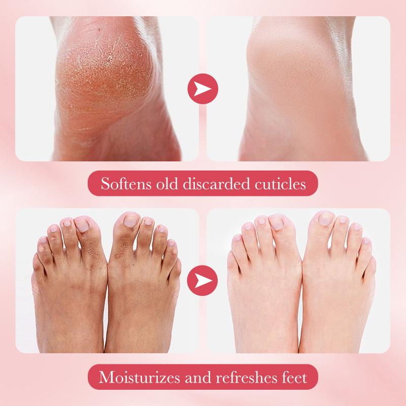 Foot Spa - 1 Paar SADOER Früchte-Fußmaske, feuchtigkeitsspendende Fuß-Peeling-Maske,